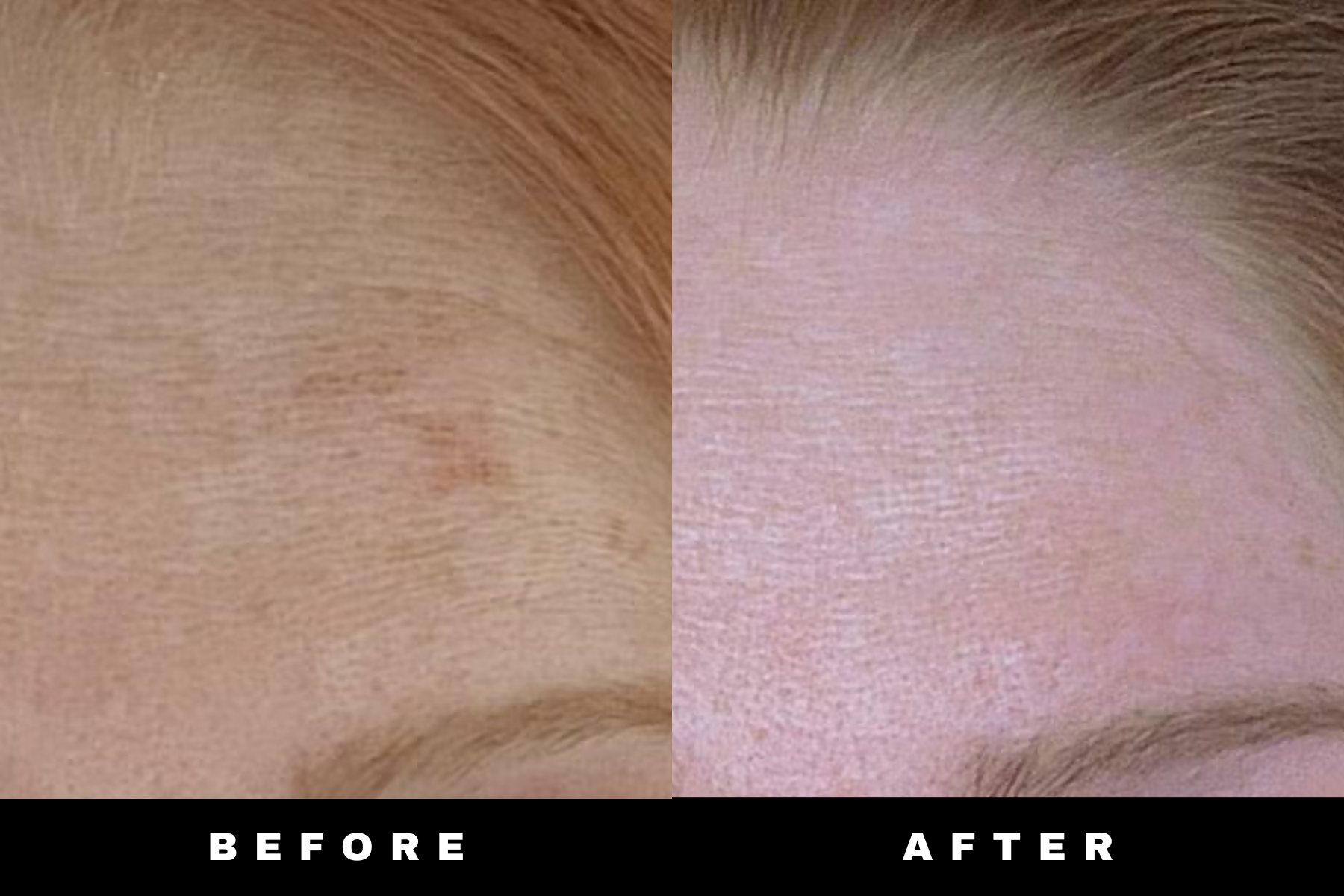 LumiBar - Turmeric & Kojic Acid Bar