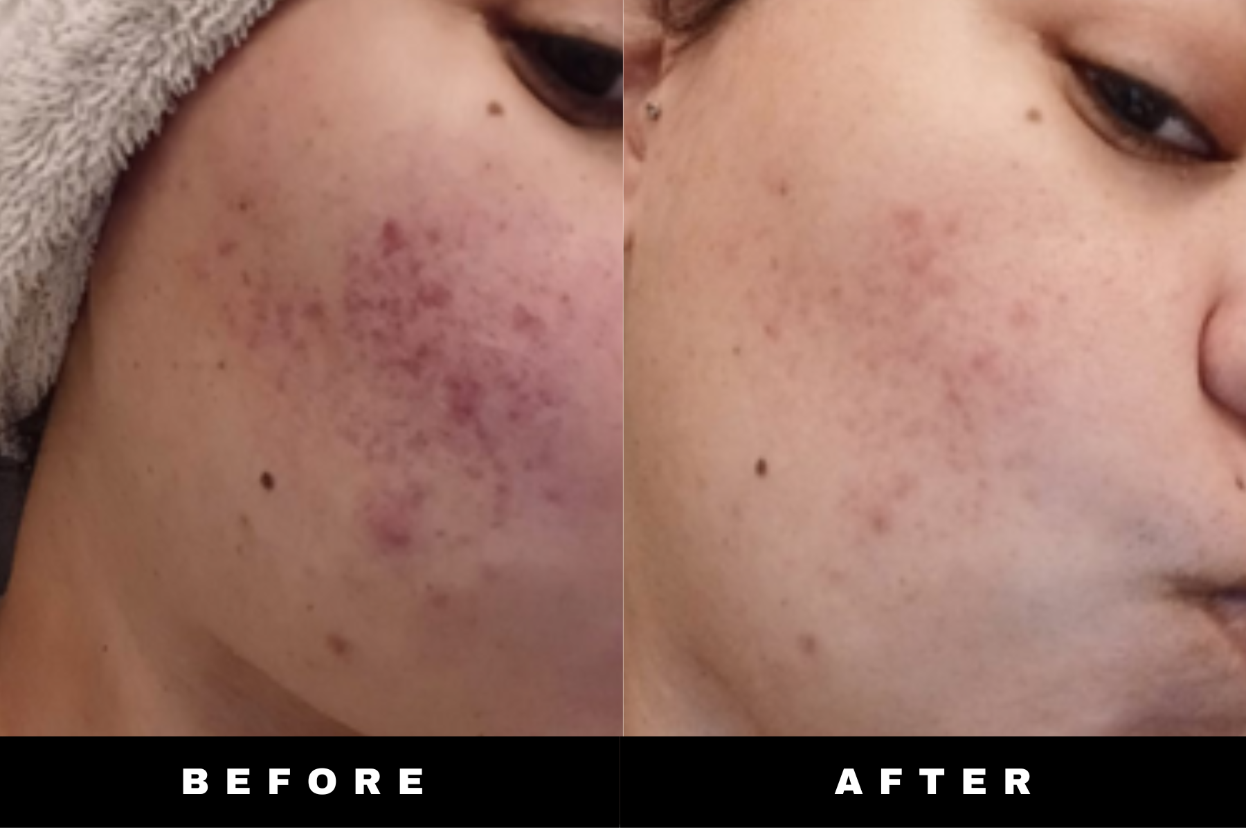 LumiFade Dark Spot Serum (Hyperpigmentation)