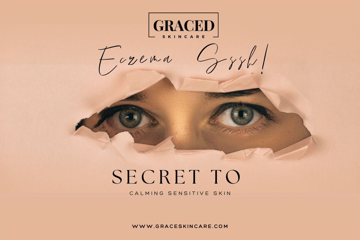 Eczema Relief Starts Here: Discover the Secret to Calming Sensitive Skin