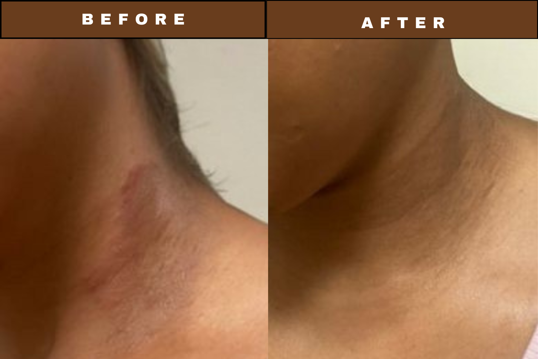LumiBar - Turmeric &amp; Kojic Acid Bar