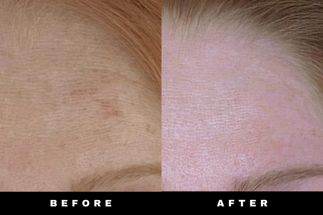 LumiBar - Turmeric &amp; Kojic Acid Bar