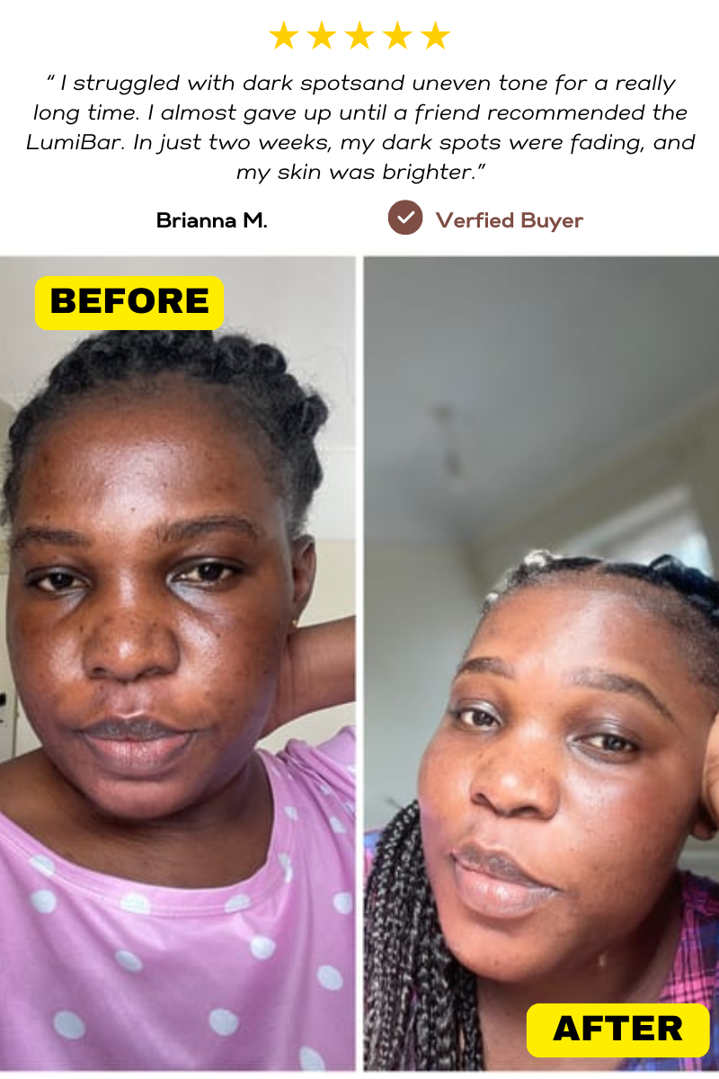 LumiBar Skin Brightening Bar