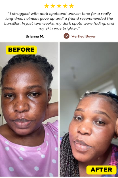LumiBar Skin Brightening Bar