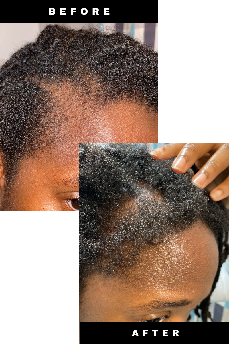 Rapid hair growth products for black hair deals