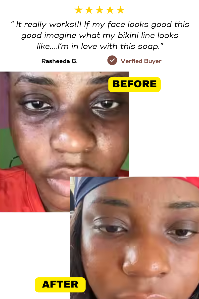 Glow Essentials Starter Kit