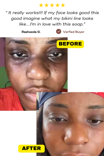 Glow Essentials Starter Kit